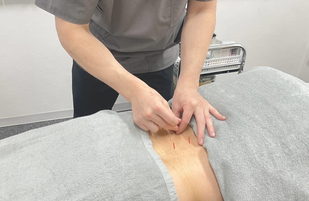 鍼灸治療